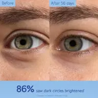 Close-up of eyes before and after 56 days. Text: "86% saw dark circles brightened".