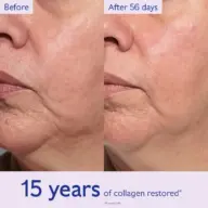 Before and after comparison of skin texture over 56 days. Text: "15 years of collagen restored".