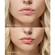Close-up of lips before and after applying Crystal Slipper gloss.