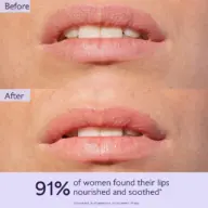 Before and after images of lips with text: 91% of women found their lips nourished and soothed.