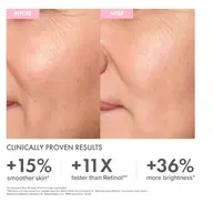 Before and after skin comparison with text: +15% smoother, +11X faster, +36% brighter.
