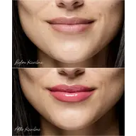 Close-up of lips before and after applying pink lip gloss.