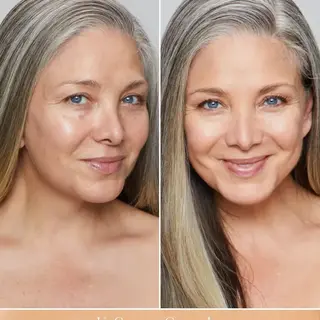 Before and after using UnCoverup Concealer, Shade 33, on a woman's face.