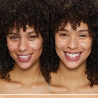 Before and after using UnCoverup Concealer, Shade 33.5.
