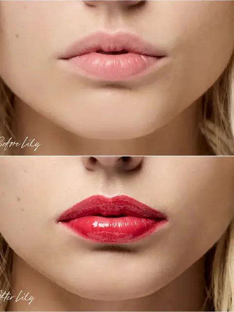 Close-up of lips before and after applying red lipstick, labelled "Before Lily" and "After Lily".