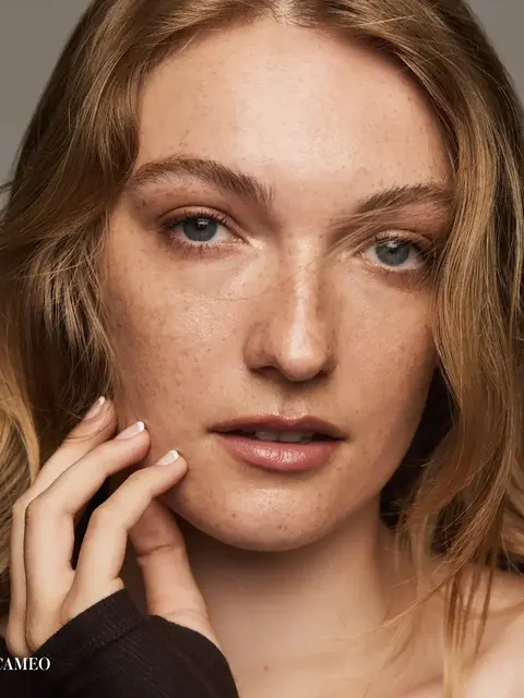 Person with freckles and light brown hair, touching face. Text: "CAMEO" in the corner.