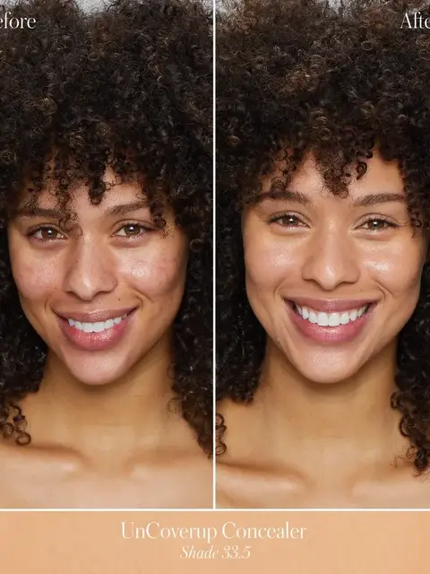 Before and after using UnCoverup Concealer, Shade 33.5.