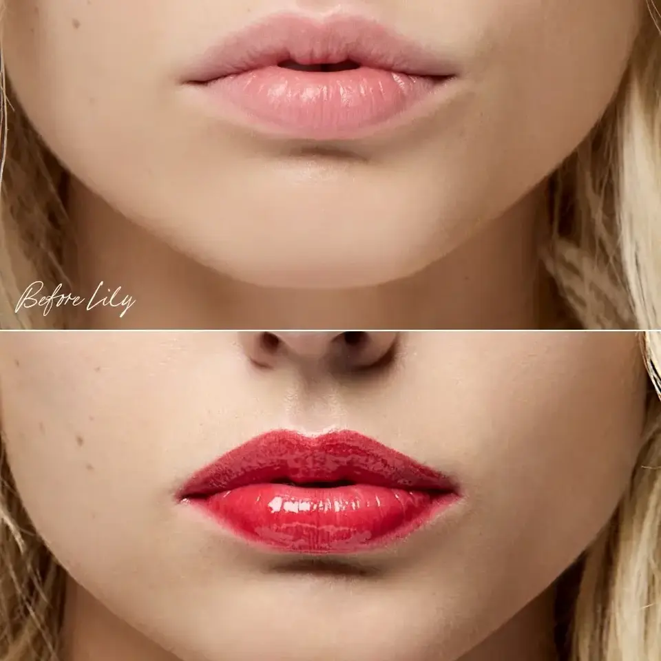 Close-up of lips before and after applying red lipstick, labelled "Before Lily" and "After Lily".