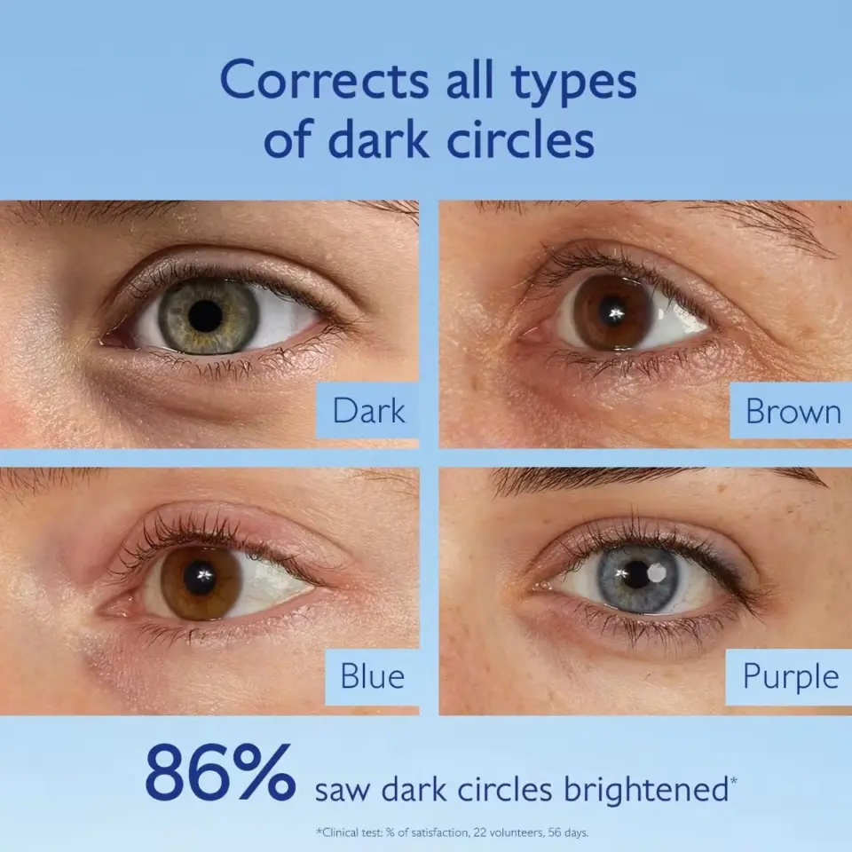 Four eyes with dark circles: dark, brown, blue, purple. Text: 86% saw dark circles brightened.
