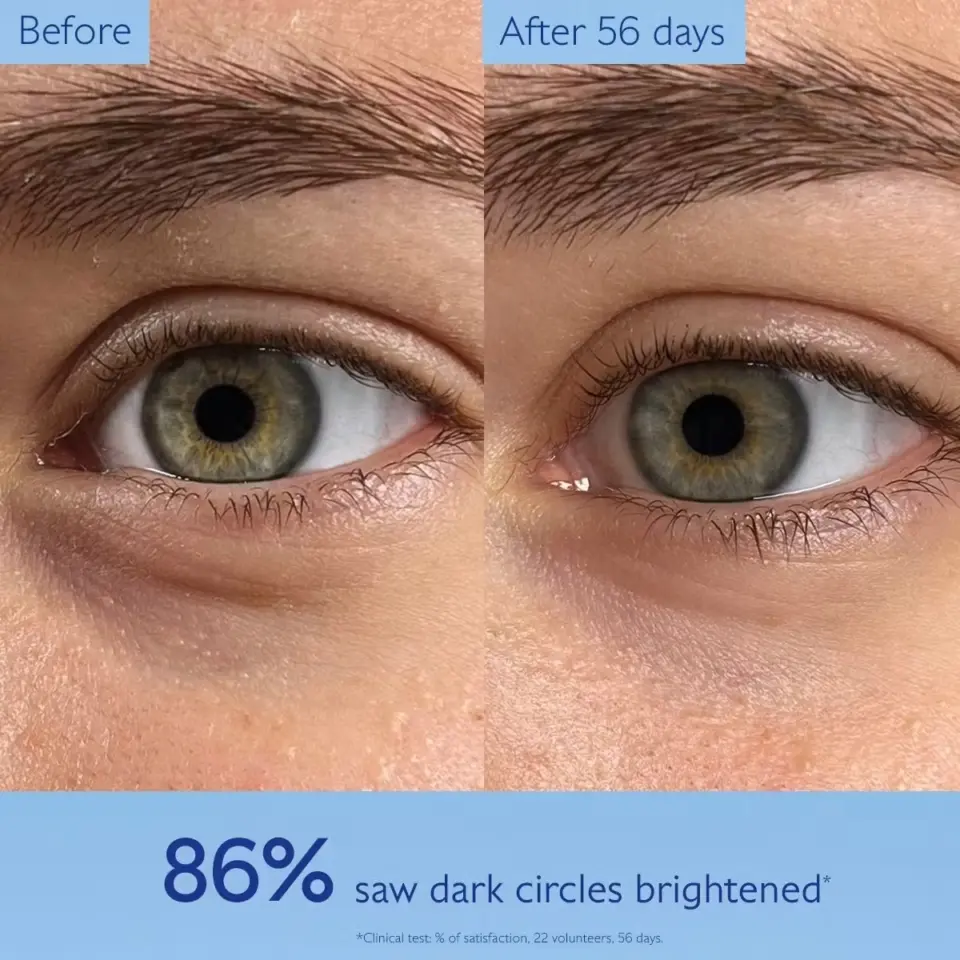 Close-up of eyes before and after 56 days. Text: "86% saw dark circles brightened".
