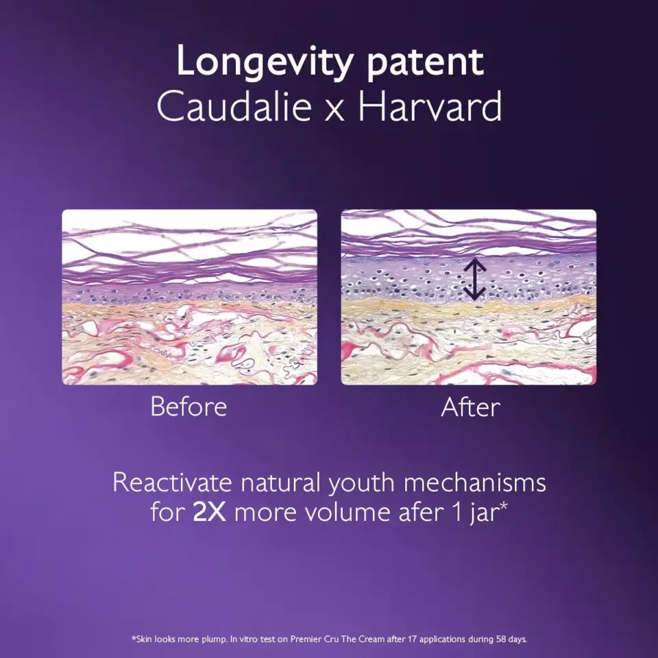 Two skin cross-sections labelled Before and After, showing increased volume. Text: Longevity patent.