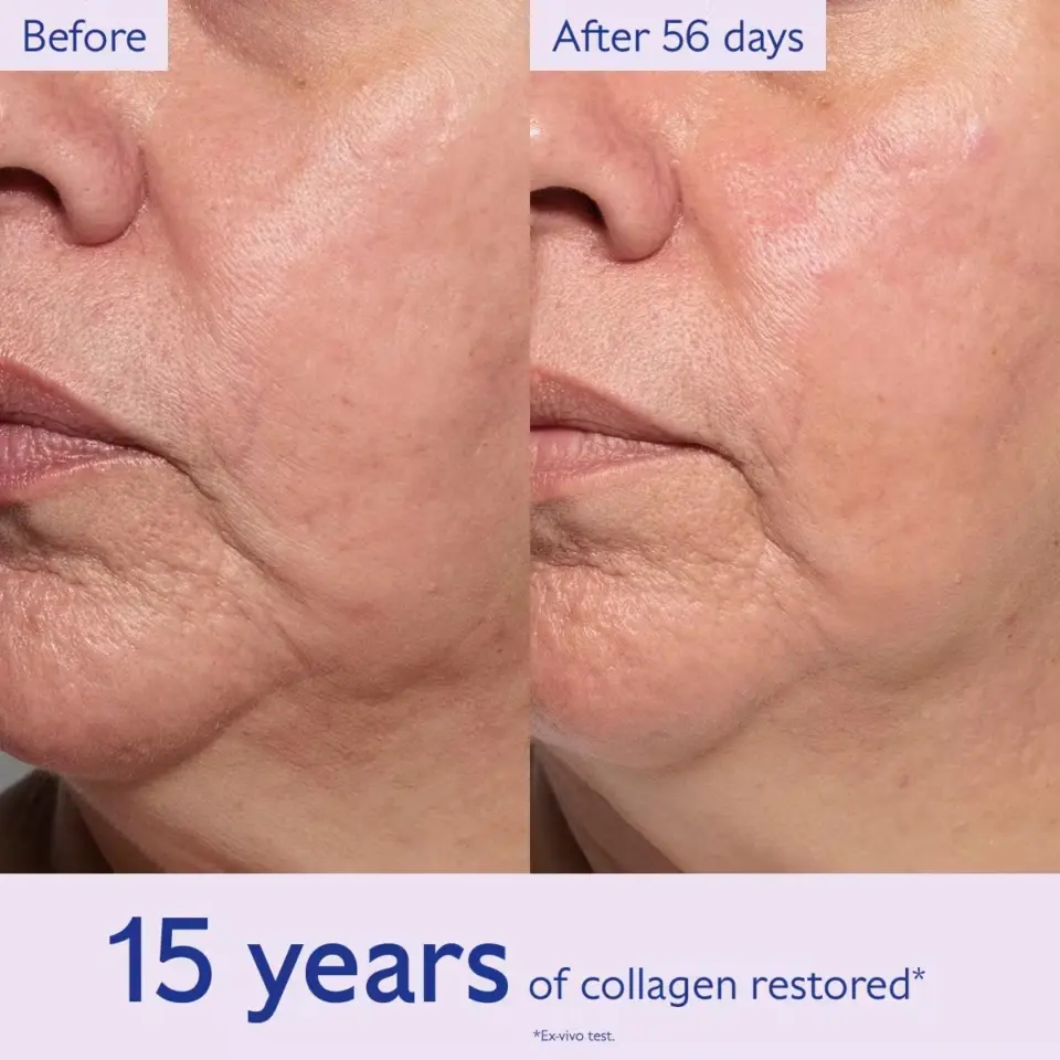 Before and after comparison of skin texture over 56 days. Text: "15 years of collagen restored".