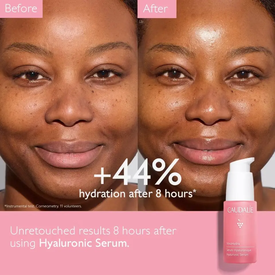 Before and after of a woman's face showing +44% hydration with Hyaluronic Serum bottle.