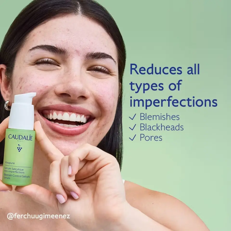 Smiling person holding Caudalie serum. Text: "Reduces all types of imperfections: Blemishes, Blackheads, Pores.