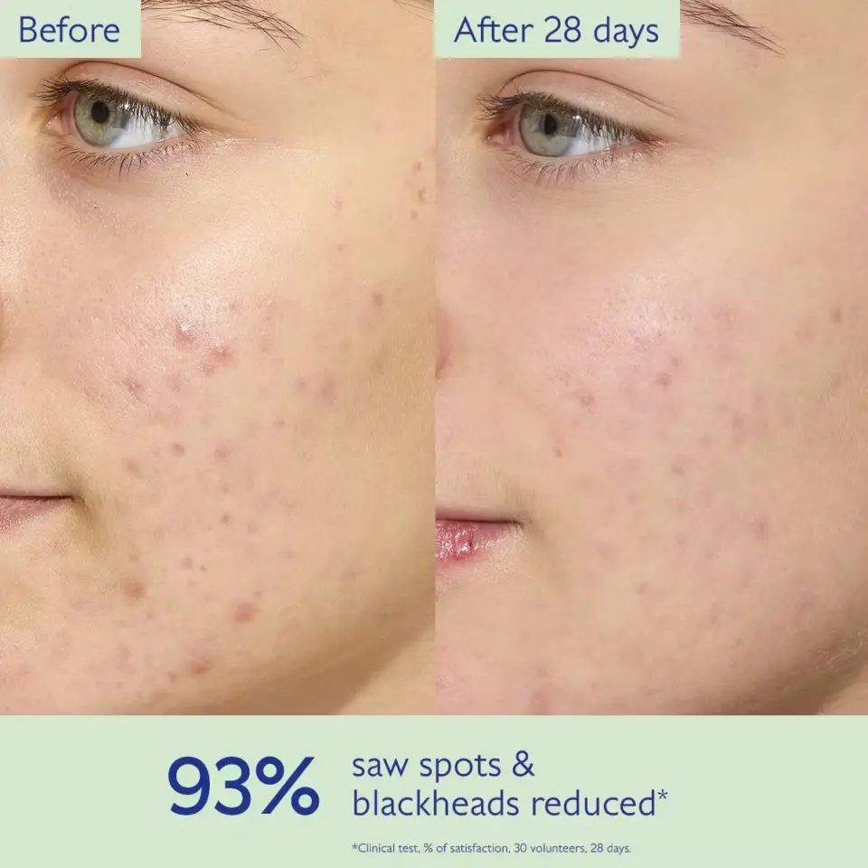 Before and after comparison of facial skin with reduced spots. Text: 93% saw spots reduced.