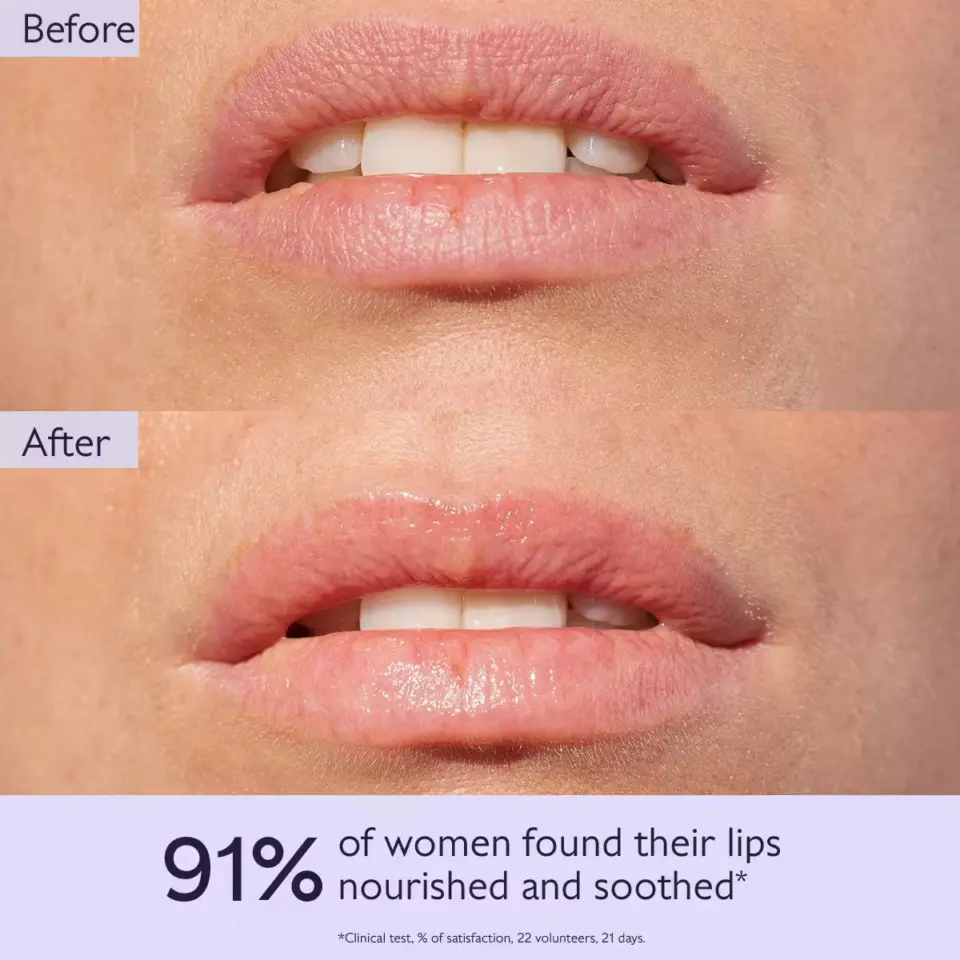 Before and after images of lips with text: 91% of women found their lips nourished and soothed.