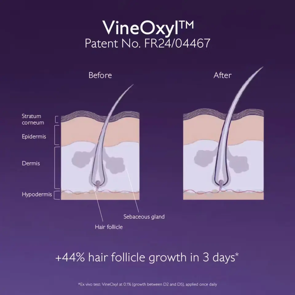 VineOxyl patent diagram showing hair follicle growth before and after. +44% growth in 3 days.