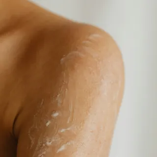 Moisturiser applied on a person's shoulder and upper arm.
