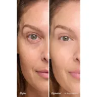 Close-up of a woman's face before and after makeup in shade Cherish.