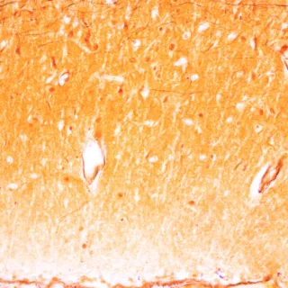 Orange and white textured surface resembling a close-up of a natural material.