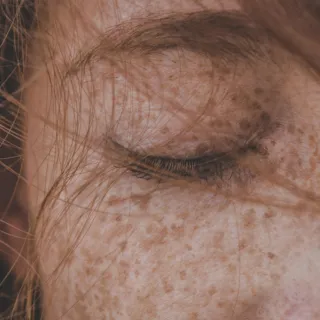 Closed eye with freckles and strands of hair across the face.