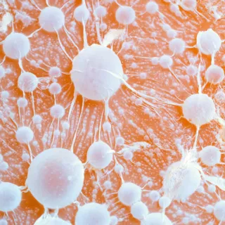 Close-up of white mould spores on an orange surface.