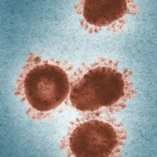Microscopic view of four brown virus particles on a blue background.